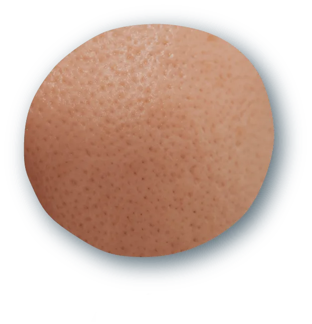 毛穴3